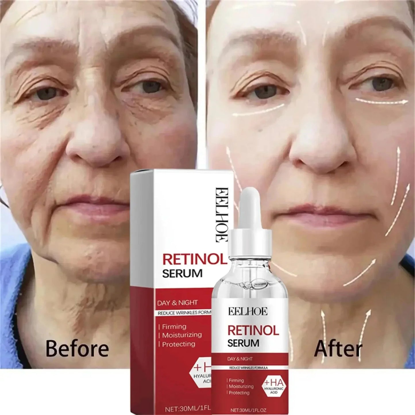 Retinol Wrinkle Removal Facial Kit Instant Firming Enhancement Anti Aging Serum Fading Fine Line Whitening Korean Skincare